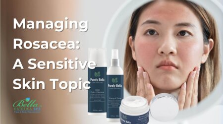 rosacea blog new